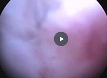 mate vid1