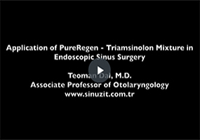 purevideo1